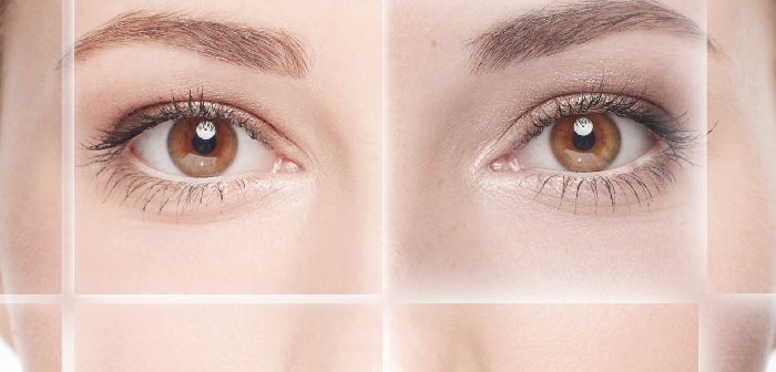 Lifting dos olhos com Ultraformer 3
